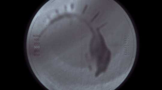 An amoeba-like creature is shown in a microscope, which will later become the worm.